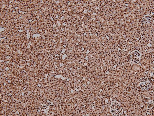 Phospho-4EBP1 (Thr36) Antibody in Immunohistochemistry (Paraffin) (IHC (P))