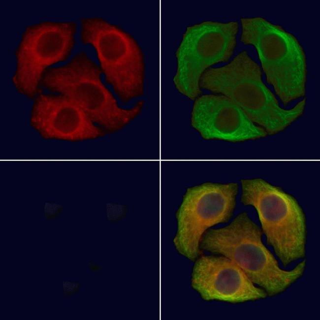 Phospho-DAPK1 (Ser308) Antibody in Immunocytochemistry (ICC/IF)