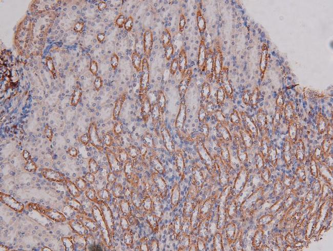 Phospho-DNA-PK (Ser2612) Antibody in Immunohistochemistry (Paraffin) (IHC (P))