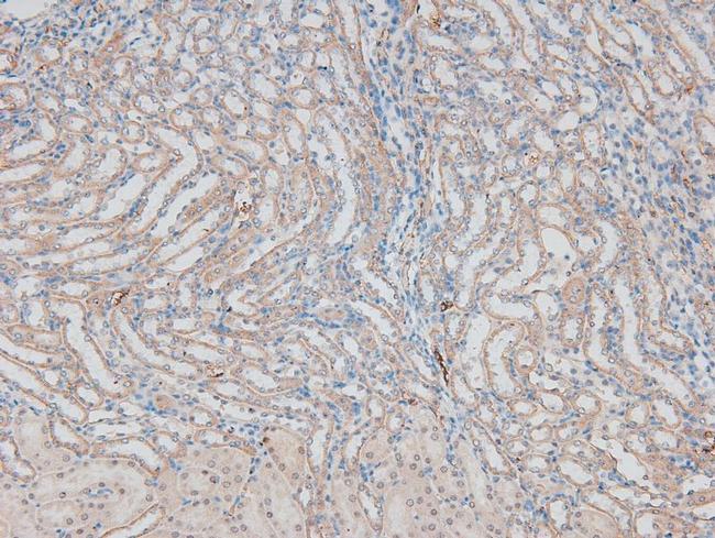 Phospho-ErbB2 (HER-2) (Thr686) Antibody in Immunohistochemistry (Paraffin) (IHC (P))