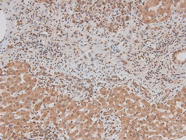 Phospho-ErbB3 (Tyr1328) Antibody in Immunohistochemistry (Paraffin) (IHC (P))