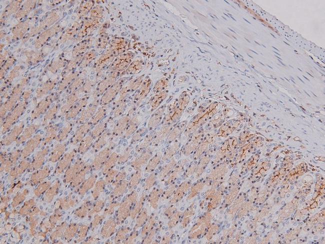 Phospho-PDGFRA (Tyr762) Antibody in Immunohistochemistry (Paraffin) (IHC (P))