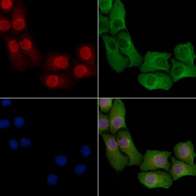 Phospho-PPAR alpha (Ser21) Antibody in Immunocytochemistry (ICC/IF)