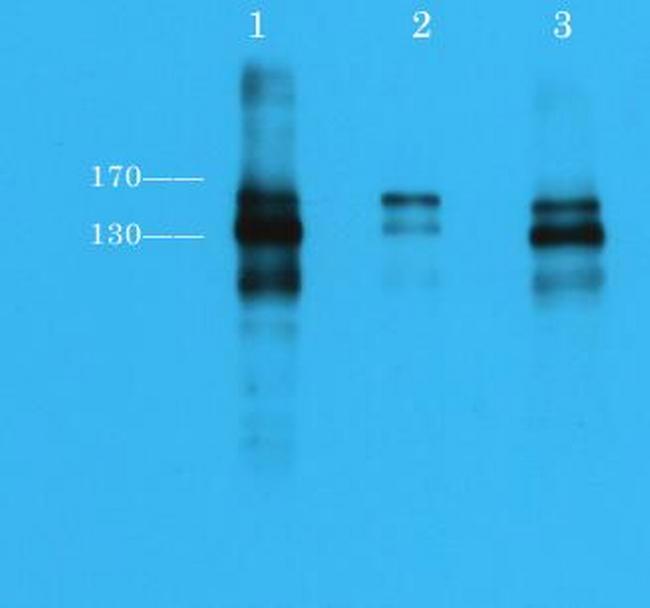 Phospho-RET (Tyr905) Antibody in Western Blot (WB)