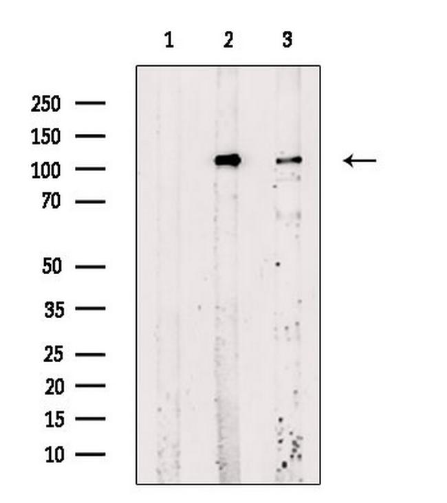 Phospho-Rb (Ser612) Antibody in Western Blot (WB)