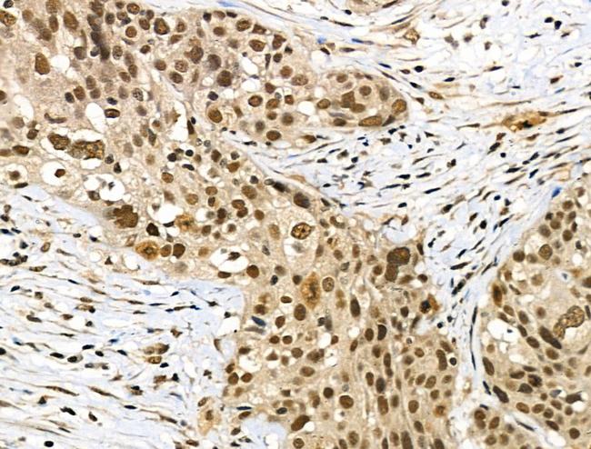 Phospho-SMAD2 (Ser255) Antibody in Immunohistochemistry (Paraffin) (IHC (P))