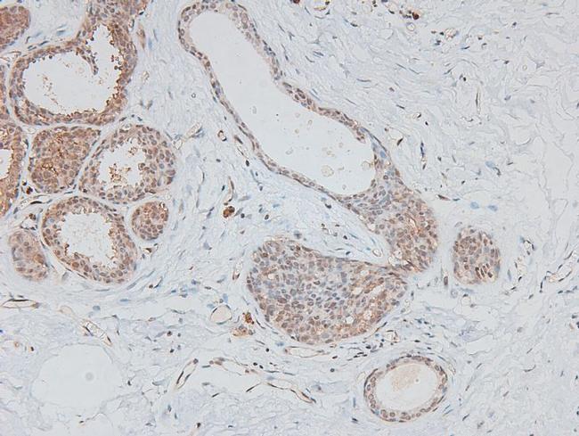 Phospho-HIC5 (Tyr60) Antibody in Immunohistochemistry (Paraffin) (IHC (P))