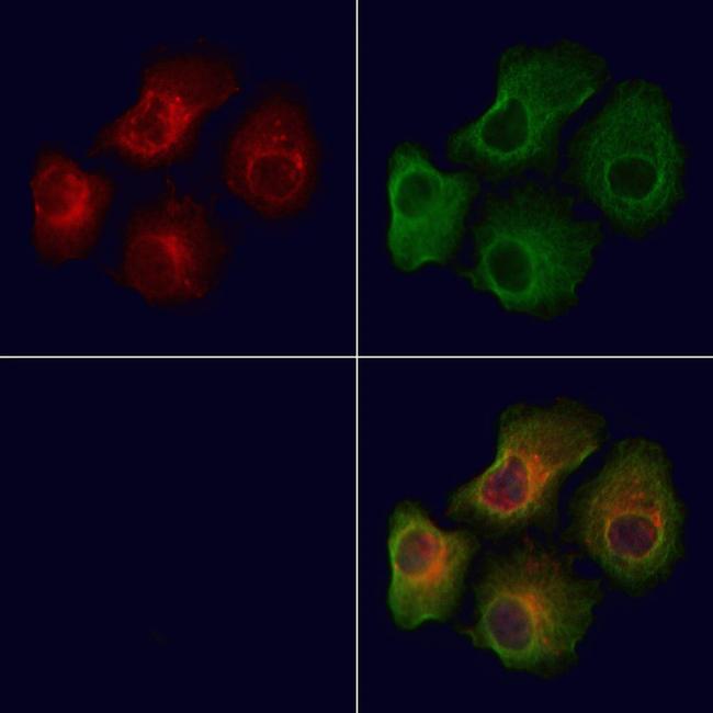 Phospho-MARK2 (Thr596) Antibody in Immunocytochemistry (ICC/IF)