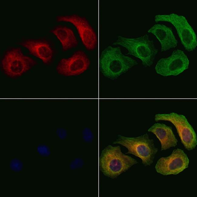 Phospho-L-Plastin (Ser5) Antibody in Immunocytochemistry (ICC/IF)