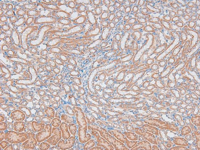 Phospho-DNA ligase IV (Thr650) Antibody in Immunohistochemistry (Paraffin) (IHC (P))