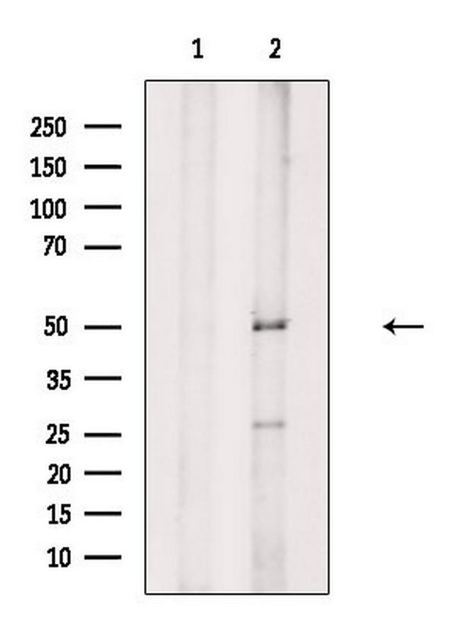 Phospho-PSEN2 (Ser330) Antibody in Western Blot (WB)