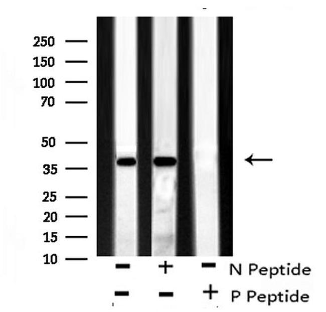 Phospho-ATF4 (Ser224) Antibody in Western Blot (WB)