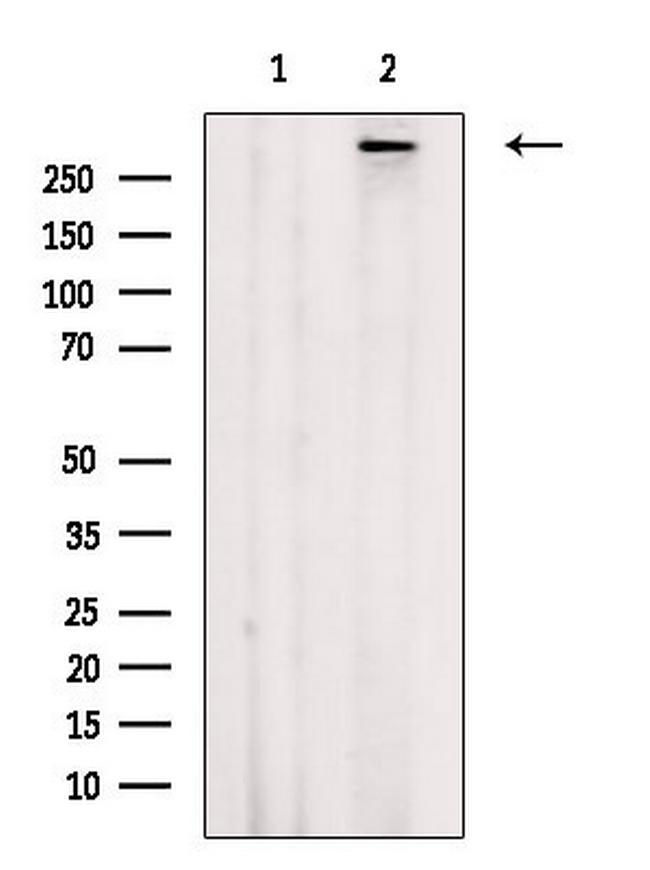 Phospho-ATM (Ser367) Antibody in Western Blot (WB)