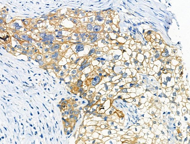 Phospho-beta Catenin (Ser675) Antibody in Immunohistochemistry (Paraffin) (IHC (P))