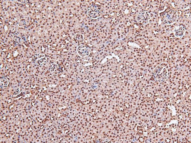 Phospho-EGFR (Tyr998) Antibody in Immunohistochemistry (Paraffin) (IHC (P))