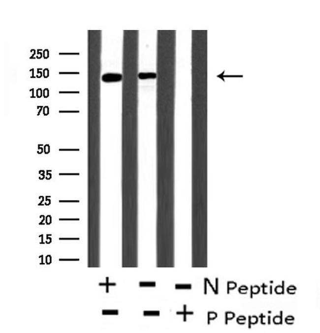 Phospho-eNOS (Ser633) Antibody in Western Blot (WB)