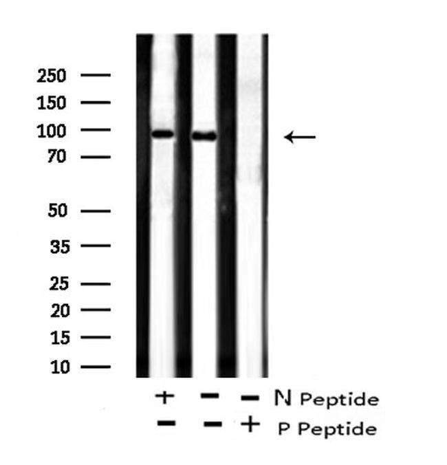 Phospho-FOXO3A (Ser644) Antibody in Western Blot (WB)