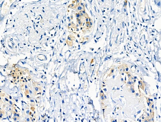 Phospho-IGF1R (Tyr980) Antibody in Immunohistochemistry (Paraffin) (IHC (P))