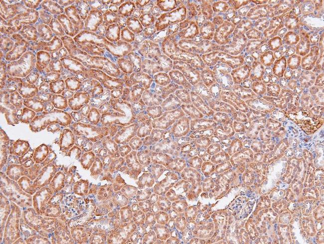 Phospho-A-Raf (Ser299) Antibody in Immunohistochemistry (Paraffin) (IHC (P))