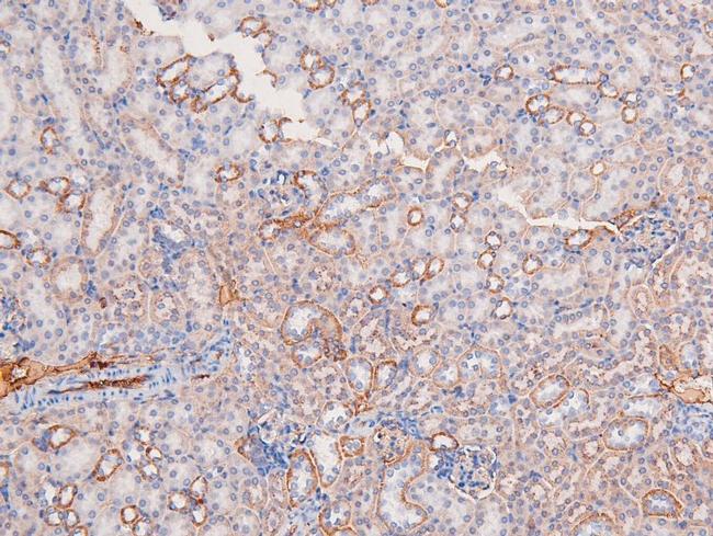 Phospho-BRK (Tyr342) Antibody in Immunohistochemistry (Paraffin) (IHC (P))