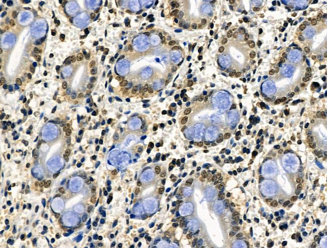 Phospho-CAMKK alpha/beta (Ser458, Ser495) Antibody in Immunohistochemistry (Paraffin) (IHC (P))