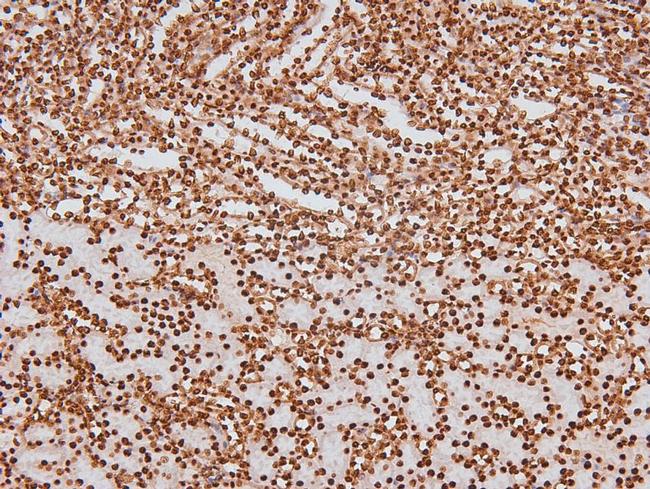 Phospho-CSK (Tyr304) Antibody in Immunohistochemistry (Paraffin) (IHC (P))