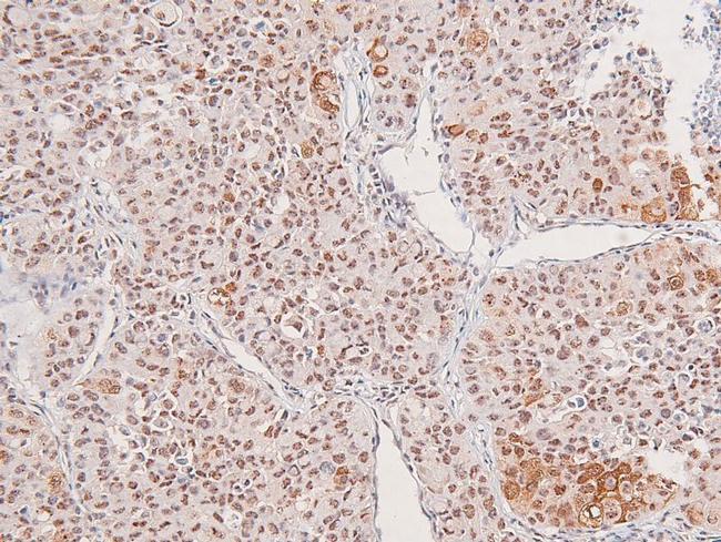 Phospho-DAPK1 (Ser734) Antibody in Immunohistochemistry (Paraffin) (IHC (P))