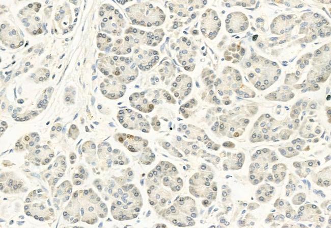 Phospho-DYRK1A/DYRK1B (Tyr321, Tyr273) Antibody in Immunohistochemistry (Paraffin) (IHC (P))