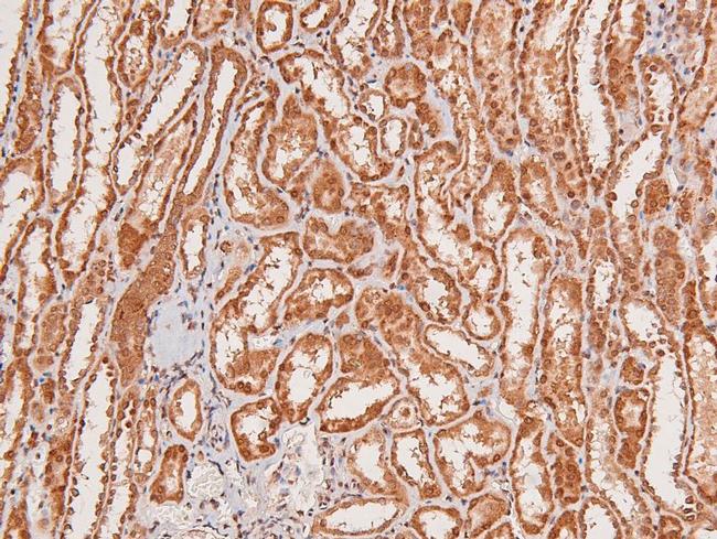 Phospho-EphA8 (Tyr839) Antibody in Immunohistochemistry (Paraffin) (IHC (P))