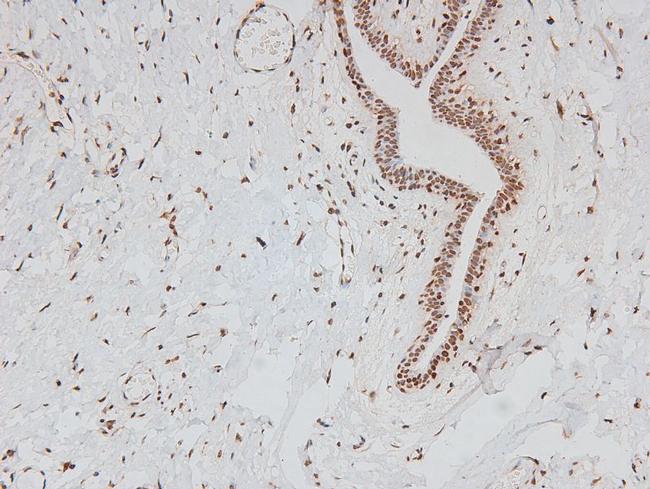 Phospho-FER (Tyr714) Antibody in Immunohistochemistry (Paraffin) (IHC (P))