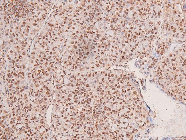 Phospho-FGFR2 (Tyr769) Antibody in Immunohistochemistry (Paraffin) (IHC (P))