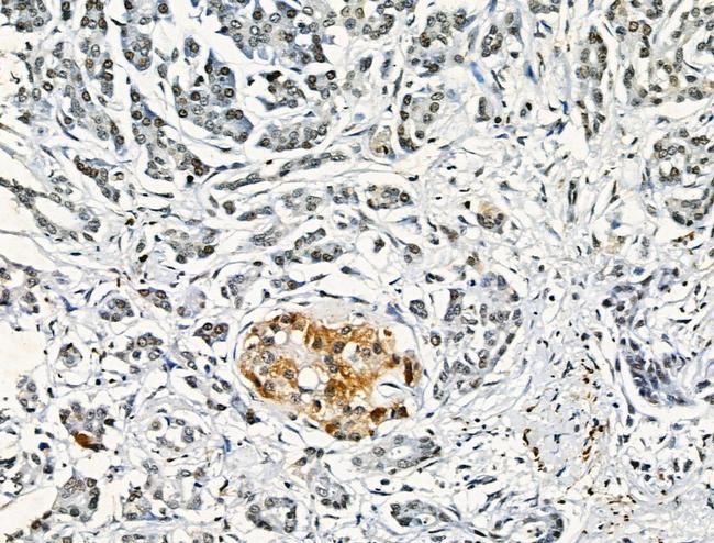 Phospho-FGFR4 (Tyr754) Antibody in Immunohistochemistry (Paraffin) (IHC (P))