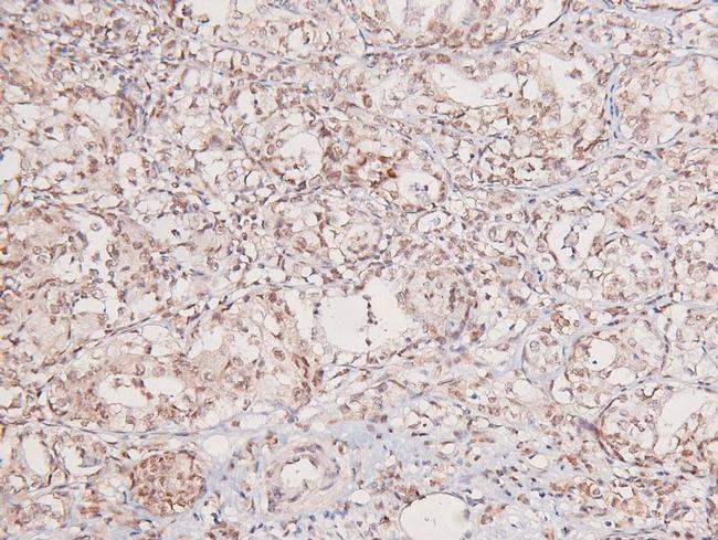 Phospho-GCN2 (Thr899) Antibody in Immunohistochemistry (Paraffin) (IHC (P))