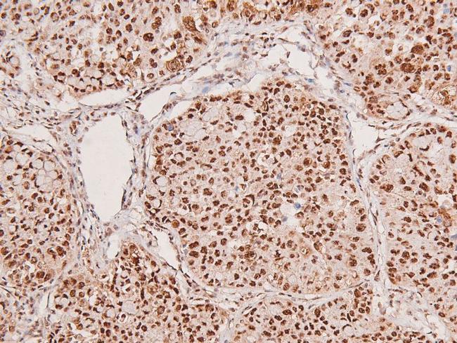 Phospho-LATS1/LATS2 (Ser909, Ser872) Antibody in Immunohistochemistry (Paraffin) (IHC (P))