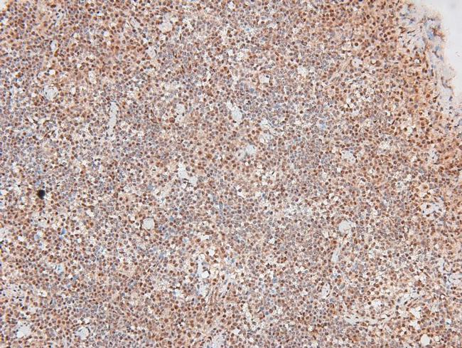 Phospho-MAP2K1/MAP2K2 (Ser212, Ser216) Antibody in Immunohistochemistry (Paraffin) (IHC (P))