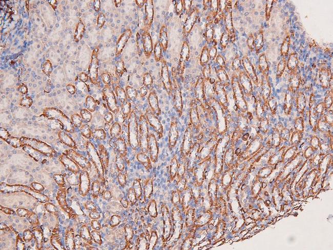 Phospho-MEK5 (Thr315) Antibody in Immunohistochemistry (Paraffin) (IHC (P))