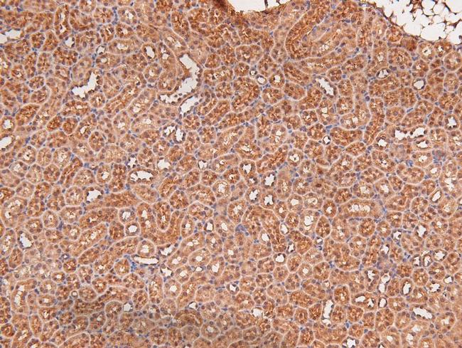 Phospho-MEK5 (Ser311) Antibody in Immunohistochemistry (Paraffin) (IHC (P))