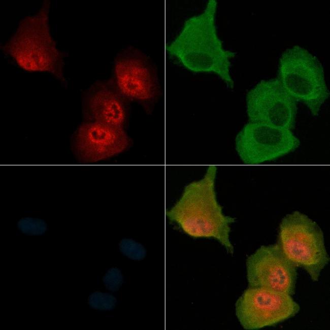 Phospho-MST3 (Thr18) Antibody in Immunocytochemistry (ICC/IF)