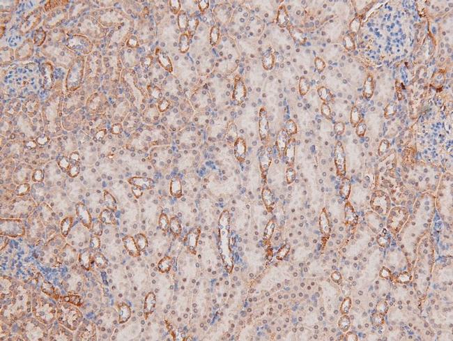 Phospho-p38 MAPK gamma/delta (Tyr185, Tyr182) Antibody in Immunohistochemistry (Paraffin) (IHC (P))