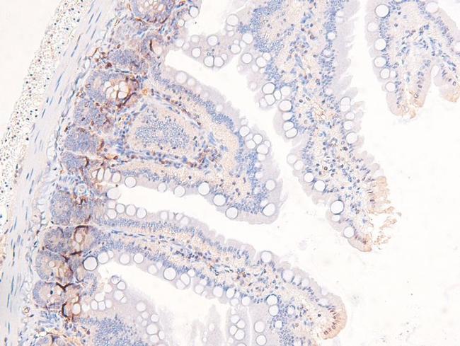 Phospho-PDGFRb (Tyr857) Antibody in Immunohistochemistry (Paraffin) (IHC (P))