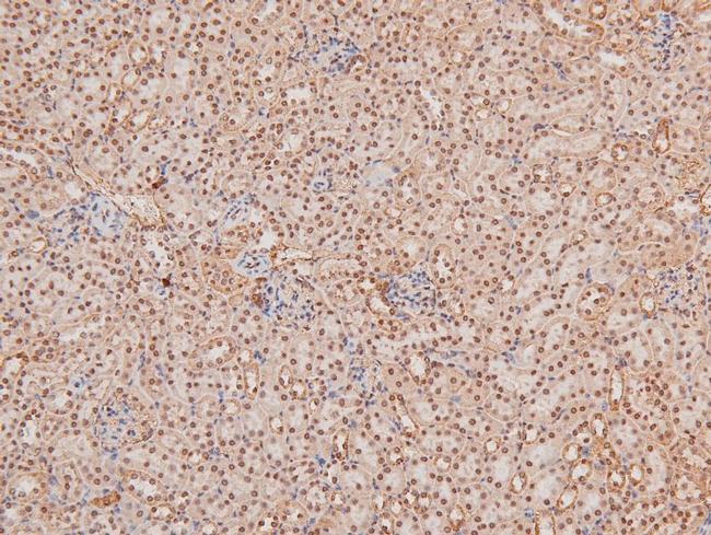 Phospho-TBK1 (Ser172) Antibody in Immunohistochemistry (Paraffin) (IHC (P))