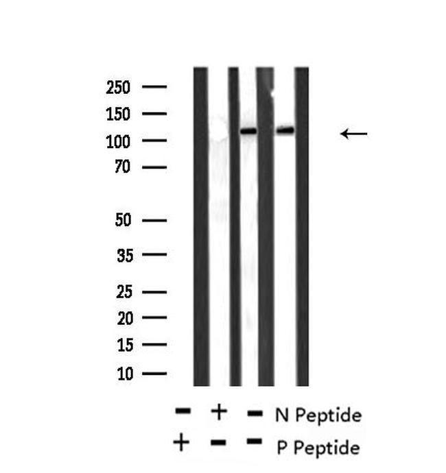 Phospho-TEK (Ser1119) Antibody in Western Blot (WB)