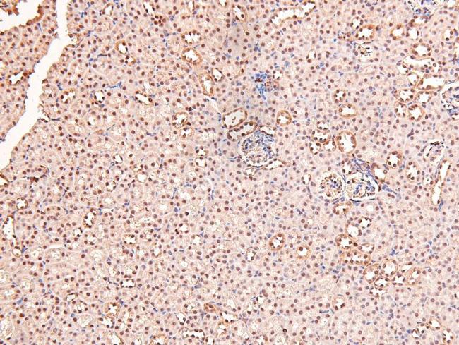 Phospho-RARA/RARB (Ser96) Antibody in Immunohistochemistry (Paraffin) (IHC (P))