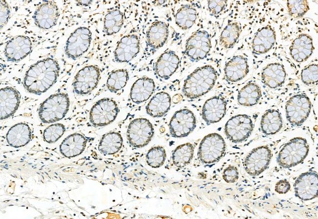 Phospho-ERK1/ERK2 (Thr202, Tyr204, Thr185, Tyr187) Antibody in Immunohistochemistry (Paraffin) (IHC (P))