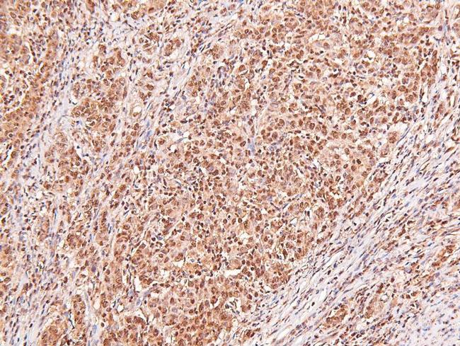 Phospho-alpha Dystroglycan (Tyr892) Antibody in Immunohistochemistry (Paraffin) (IHC (P))