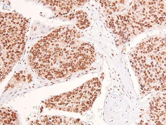 Phospho-EphB1/EphB3/EphB4 (Tyr778, Tyr792, Tyr774) Antibody in Immunohistochemistry (Paraffin) (IHC (P))