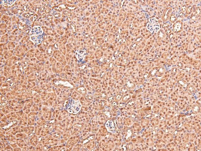 Phospho-FGFR1/FGFR2 (Tyr730, Tyr733) Antibody in Immunohistochemistry (Paraffin) (IHC (P))