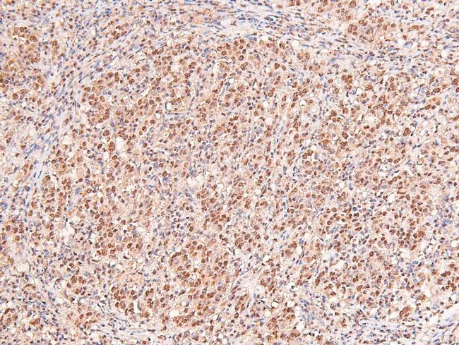 Phospho-IFNAR1 (Ser535) Antibody in Immunohistochemistry (Paraffin) (IHC (P))