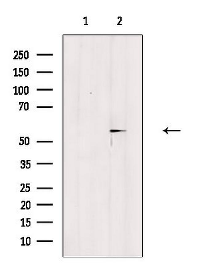 Phospho-ESR2 (Ser87) Antibody in Western Blot (WB)