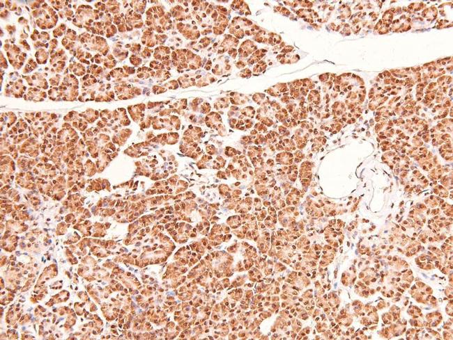 Phospho-Bim (Ser44, Ser104) Antibody in Immunohistochemistry (Paraffin) (IHC (P))